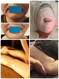 新ミニモ限定❣️レチノールプラセンタ美肌再生コース（石膏パック&脚部リフレ&ヘッド付き）100分