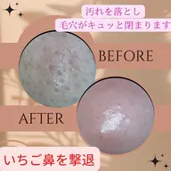 いちご鼻撃退！ツルツル鼻に！特許製法で作られたジェルを使用！メイクのノリも変わります！メンズもok