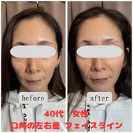 美顔整体 2回目以降