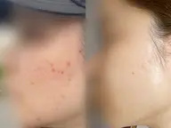 【ご新規様限定✨】フェイシャルエステ&メイクアップ　初回のみ60分/11000円→3980円で施術できます💆🏻‍♀️