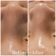 【鎮静・土台ケア】HAAB REPROリカバリートリートメント