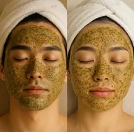 【剥離なし】ハーブピーリング🌿ニキビ,赤み,くすみ