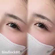 バインドロック60束