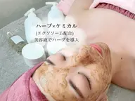 🩵minimoセール🩵【 剥離なし!!ハーブピーリング×ポレーション 】シミ･肝斑･毛穴