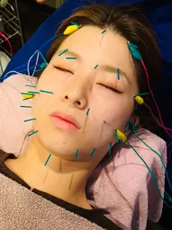 リピーター様用🌸美容鍼60分コース【12800円→10000円♡】20%OFF!