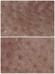 毛穴のつまりやザラつきが気になる方へ《超音波洗浄付フェイシャル​〜​デコルテケア》60分（メンズ可）