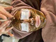 ナークハーブピーリング