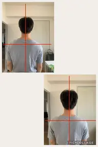 首がしんどい、つらい!お試しキャンペーン(2回で1,980円)