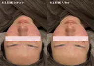 LDM水玉リフティング