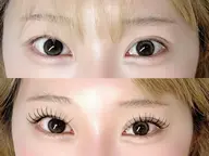 【ミニモ学割U24】60分つけ放題フラットラッシュ🎀オフ別🎀120本保証/次回予約で2回目以降も同料金ご案内◎