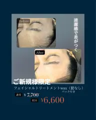 🟦メンズ限定🟦フェイシャルトリートメントwax脱毛（髭なし）
