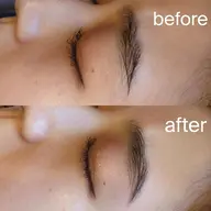 ハリウッドブロウリフト