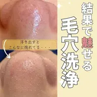 SNSで大人気の浮き出る毛穴洗浄