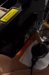 フェイシャル光脱毛