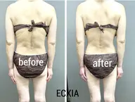 【最強痩身☆】背面半身コース初回価格!!背中→足裏まで背面中心メニュー！！首肩・背中の疲れも◎