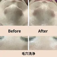 【黒ずみ/ざらつき/皮脂過多】毛穴すっきり洗浄＋保湿ケア