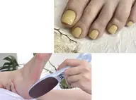 フレッシュクーポン!!フット👣ワンカラー 角質ケア/オフあり🍑