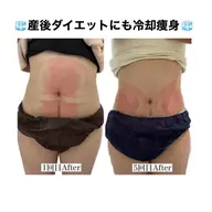 【1部位】冷却痩身❄️