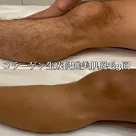 ●ミニモ限定【ひざ下＋足の甲・指】メンズ◎¥4000