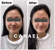 モニター★人気No.1★【整形級の小顔矯正】＋【脳洗浄/頭皮はがし】で更に小顔効果◎小顔をより実感したい方は絶対こちら！