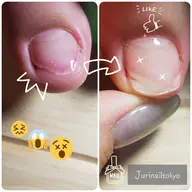 足爪 綺麗に！薄い爪、折れたつめおすすめです(1本)このメーニュはジェルをやるときのメーニュでございます