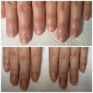 自爪育成ネイルケア３ヶ月コース