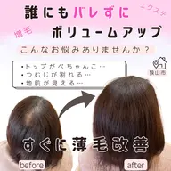 【ご新規様限定】すぐに薄毛改善❣️結び目が細かく誰にもバレない増毛エクステ3００本！シャンプーやカラー普段通り生活OK!