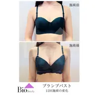 【初回体験】プランプバスト★全身ケアで理想の形・大きさを手に入れる