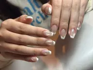 チップフレンチー