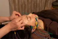 【韓国ヒロインコース】 ♥️鍼100本【お顔+全身】小顔/肩こり/巻き肩/むくみ/全身疲労を同時に🪡欲張り美容鍼90分