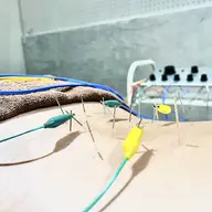 🌟当院人気No.1メニュー🌟 鍼施術(全身鍼)+パルス(電気鍼)+マッサージ