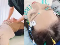 【骨盤歪み・むくみOFF】骨盤調整×EMS×美容鍼