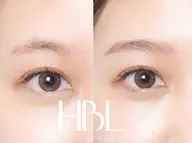 ハリウッドブロウリフト