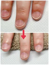 メンズネイルケア(甘皮処理)