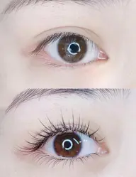 フラットラッシュ(100本)