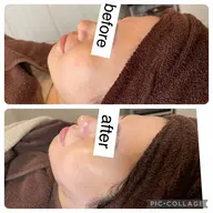 フェイシャルwax
