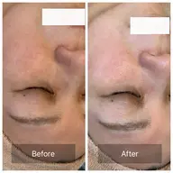 くすみ・エイジングコース🪻【通常9,800円】約90分