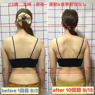 美背中エステ　天使の羽を出す　所要45分