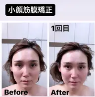小顔筋膜矯正💆‍♀️パック付き⭐️