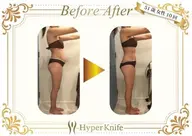 【人気No.1痩身】ハイパーナイフ6×アロマリンパ 70分