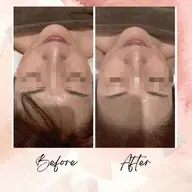 頭蓋骨小顔矯正モニター　1​〜​6回まで　60分