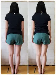 お試し美容整骨