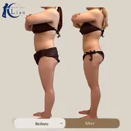 【ぽっこりお腹、ウエスト引き締め集中痩身】部位限定メニュー⭐️