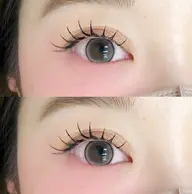 フラットラッシュ100本