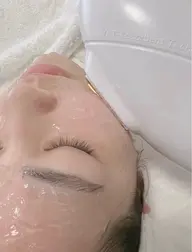 【光フェイシャル】シミ/しわ／たるみ/くすみ／赤ら顔改善 60分　初回7800円