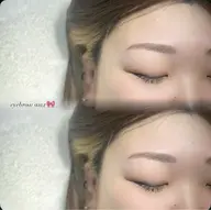 ワックス脱毛