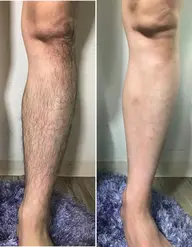 女性のみ【全身脱毛】　今からサロン脱毛してつるつるなお肌に！VIOが得意な施術者！都度支払いOK