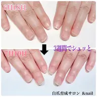 自爪育成ジェル（ホームケア付き）初回1000円OFF