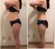 【平日ニミモU25限定】凸凹肉割れ撃退❗️最新痩身機器🌟90分全身痩せ2回セット✨通常￥44,000→¥15000