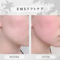 💎EMSリフトケア💎《たるみ・フェイスラインが気になる方》
